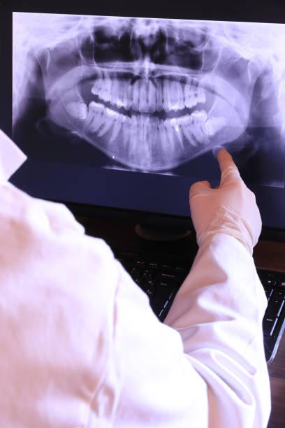 Best Knocked-Out Tooth (Avulsed Tooth) Treatment in Savanna, IL