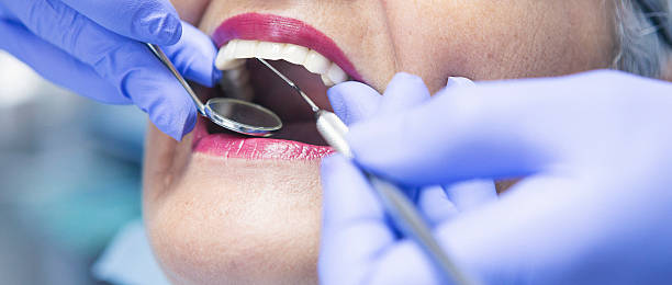 Best Broken or Chipped Tooth Repair in Savanna, IL
